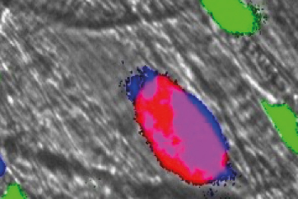 Realtime-intravital-Imaging-of-a-thrombus-in-a-living-mouse